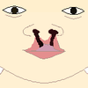 Cleft lip left right front.png