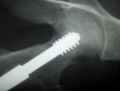 Cdm hip implant closeup 354.jpg