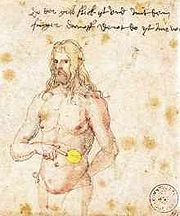 Albrecht Dürer weist auf seine Malaria-Symptome hin