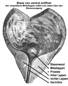 Schnittbild der Prostata