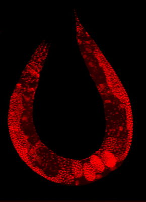 Wildtyp C. elegans Hermaphrodit, eingefärbt um Zellkerne hervorzuheben