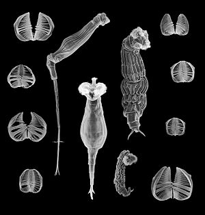 Verschiedene Bdelloida der Gattung Rotaria und deren Kieferstrukturen
