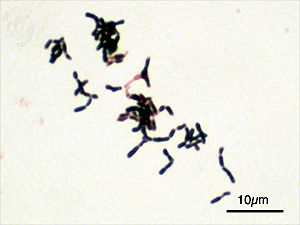 Bifidobacterium adolescentis nach Gram gefärbt, lichtmikroskopisch