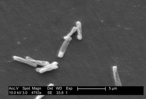Elektronenmikroskopisches Bild von Clostridium difficile