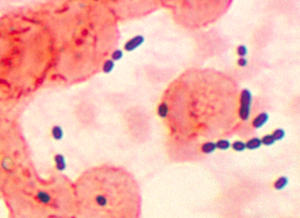 Enterococcus sp.