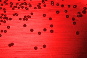 Kolonien von Haemophilus influenzae (Ordnung Pasteurellales) in einem Blutagar