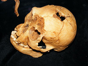 Schädel und Unterkiefer LB1 von Homo floresiensis