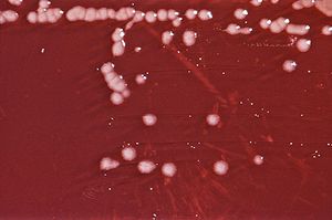 Kolonien von Pseudomonas aeruginosa in einem Blutagar